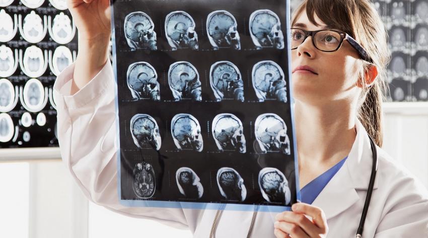 Female doctor holding brain scans.
